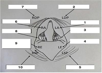 Clinical effects and pharmacokinetics of nebulized lidocaine in healthy horses